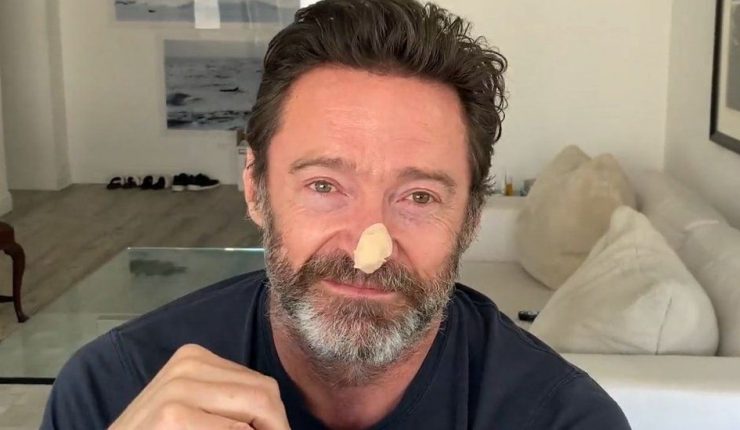 Hugh Jackman da negativo en dos biopsias ante el riesgo de cáncer de piel
