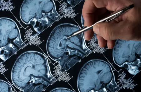 Demuestran la importancia del eje hígado-cerebro en la enfermedad de Alzheimer