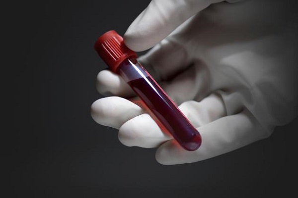 Tatuaje biomédico detecta niveles de calcio en la sangre